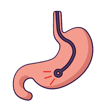 Gastro Intestinal