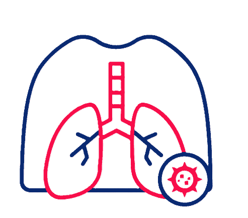 Bronchitis