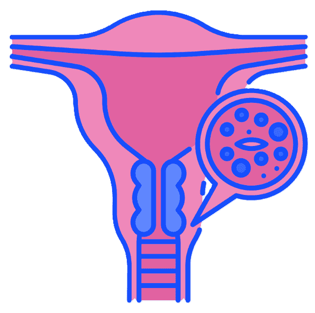 Leucorrhoea