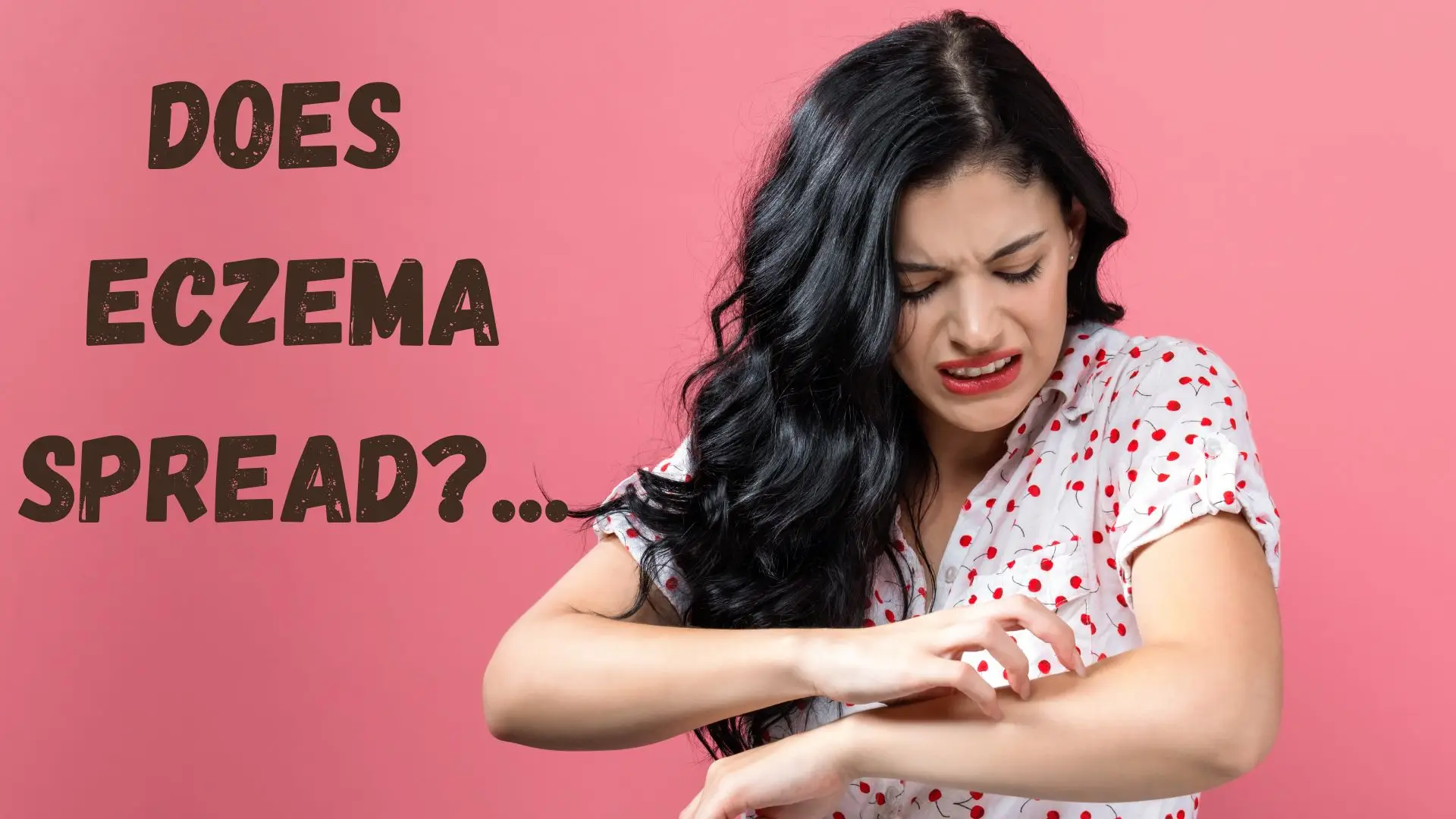 Does Eczema Spread?Transmission Patterns of Eczema