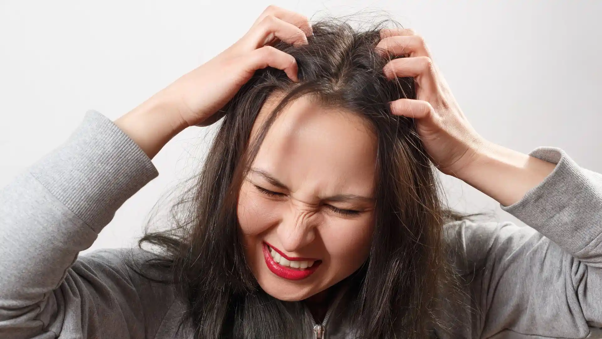 Homeopathy for Scalp Issues: Holistic Care for Hair Loss and Dandruff