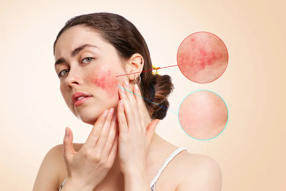 Surprising Benefits of Using Homeopathy for Sensitive Skin Conditions