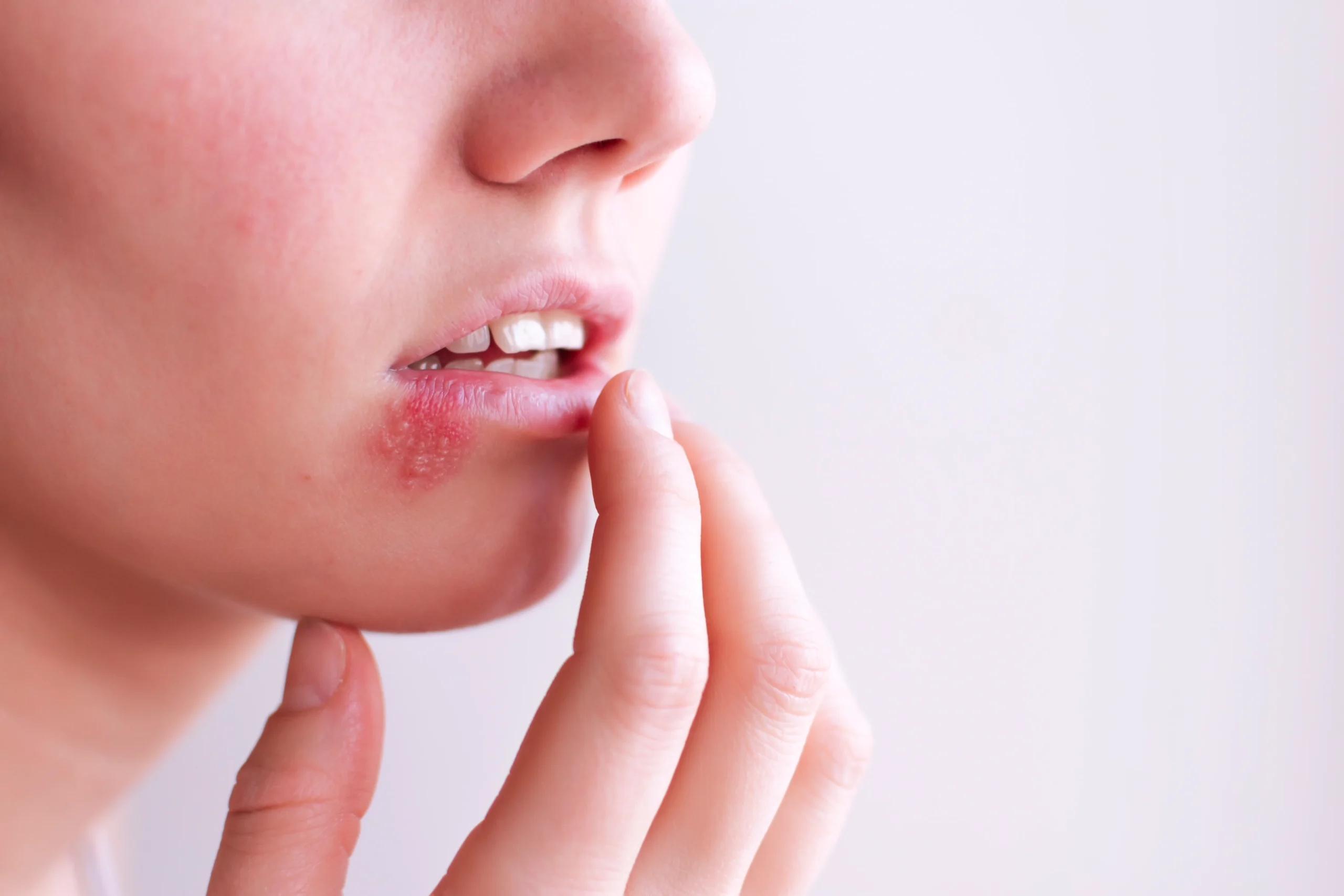 Herpes and Alzheimer’s: Emerging Links and What They Mean for You