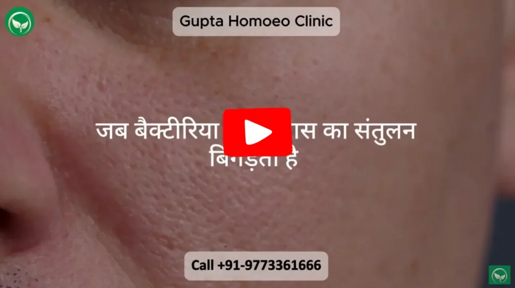Close-up video of skin texture; Gupta Homoeo Clinic advertisement.