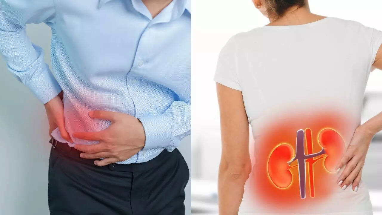How India’s Heatwave is Fueling a 40% Rise in Kidney Stones Among Young Adults